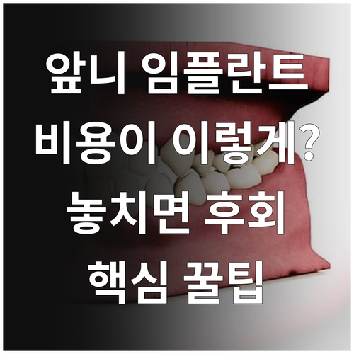 앞니 임플란트 비용 결정 요인 | 재료와 뼈 상태별 차이
